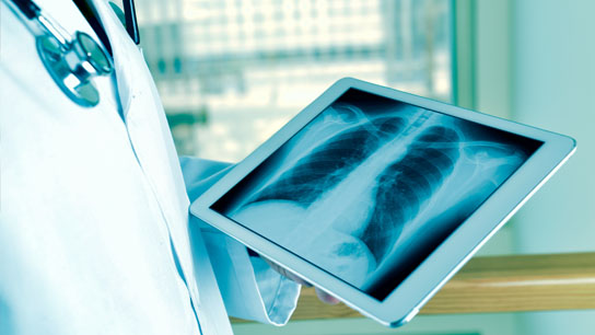 Chest x-ray