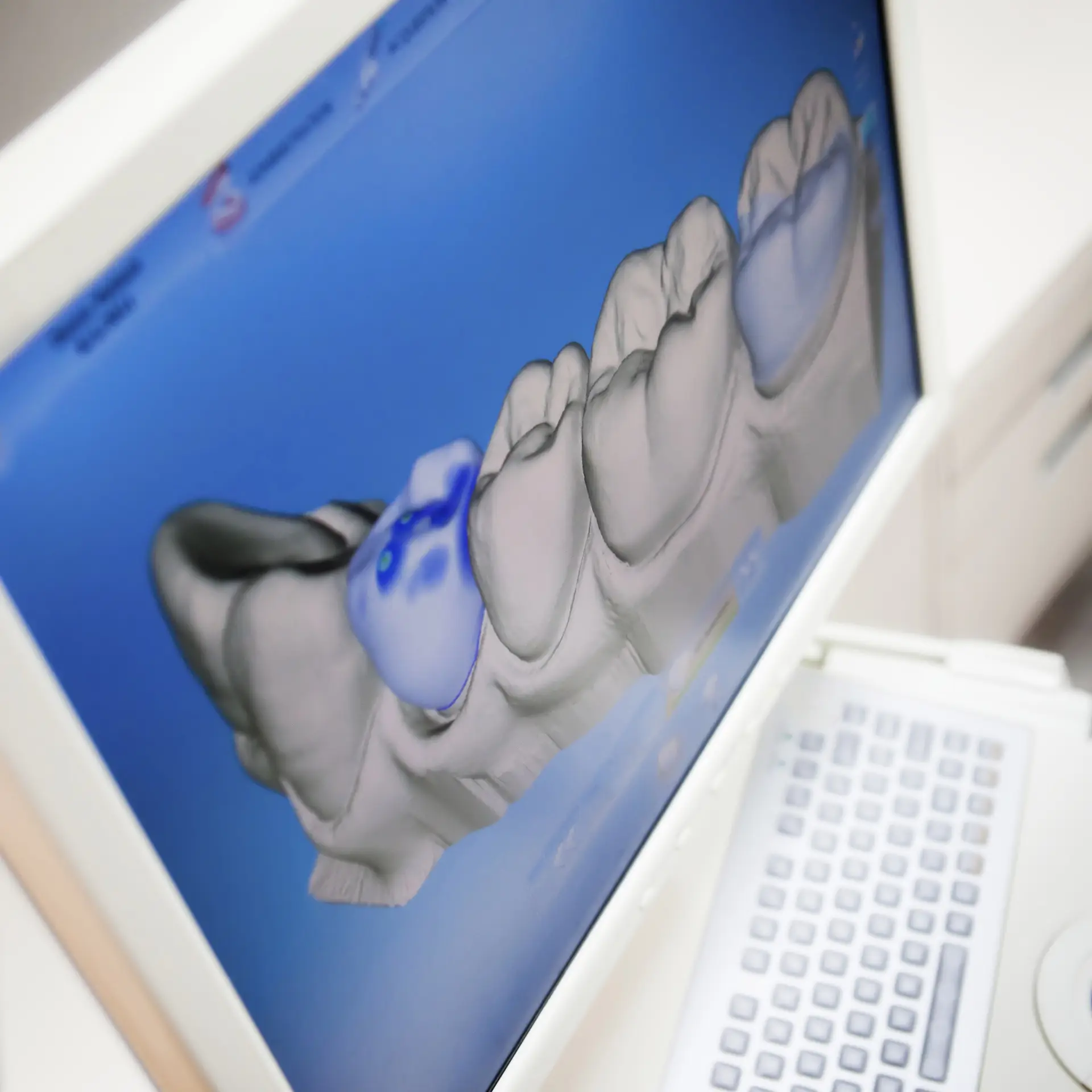 Dental 3D Scan